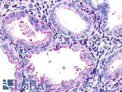 PathPlus™ Polyclonal Rabbit anti-Human RXFP1/ LGR7 Antibody (N-Terminus, IHC)