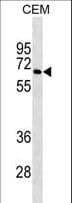 Monoclonal Mouse anti-Human BLNK Antibody (aa150-178, WB)