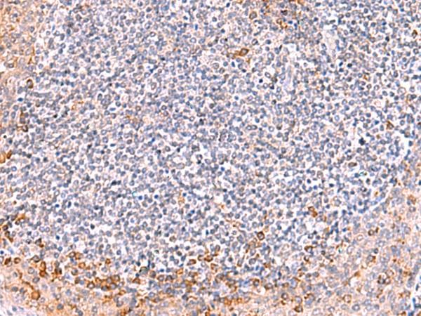 Polyclonal Rabbit anti-Human ITSN2 Antibody (IHC)