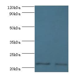 DNAL1 Antibody (aa41-190)