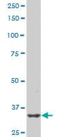 PBK / TOPK Antibody (clone 1E11)