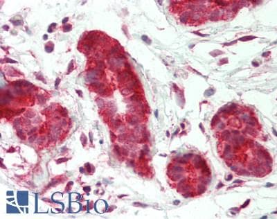 IHC-plus™ Polyclonal Rabbit anti-Human STAT2 Antibody (C-Terminus, IHC, WB)