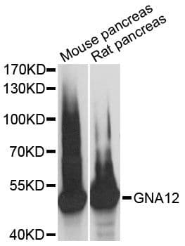 Polyclonal Rabbit anti-Human GNA12 Antibody (WB)