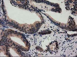 SQSTM1 Antibody (clone OTI4G9)