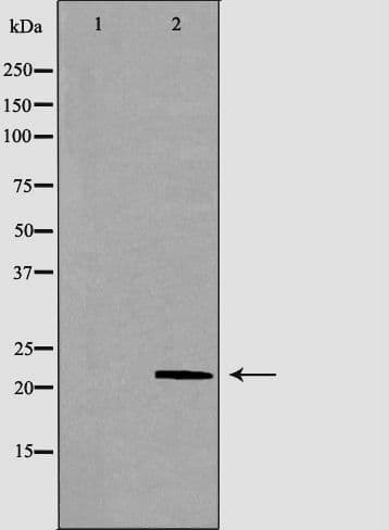 Polyclonal Rabbit anti-Human RHOC Antibody (IHC, WB)
