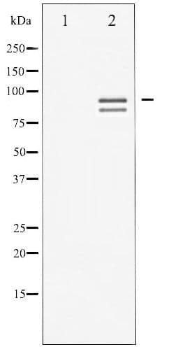 GYS1 / Glycogen Synthase Antibody (phospho-Ser645)