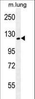 SPECC1L Antibody (aa108-136)