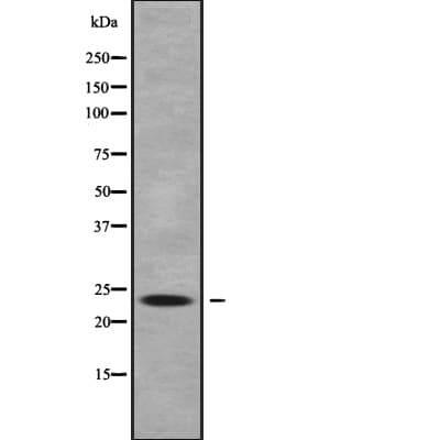 Polyclonal Rabbit anti-Human GINS1 / PSF1 Antibody (WB)