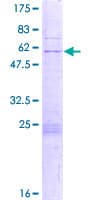 Human ZNF688 Protein (Recombinant GST)