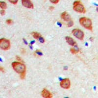 RPL22 / Ribosomal Protein L22 Antibody (Internal)
