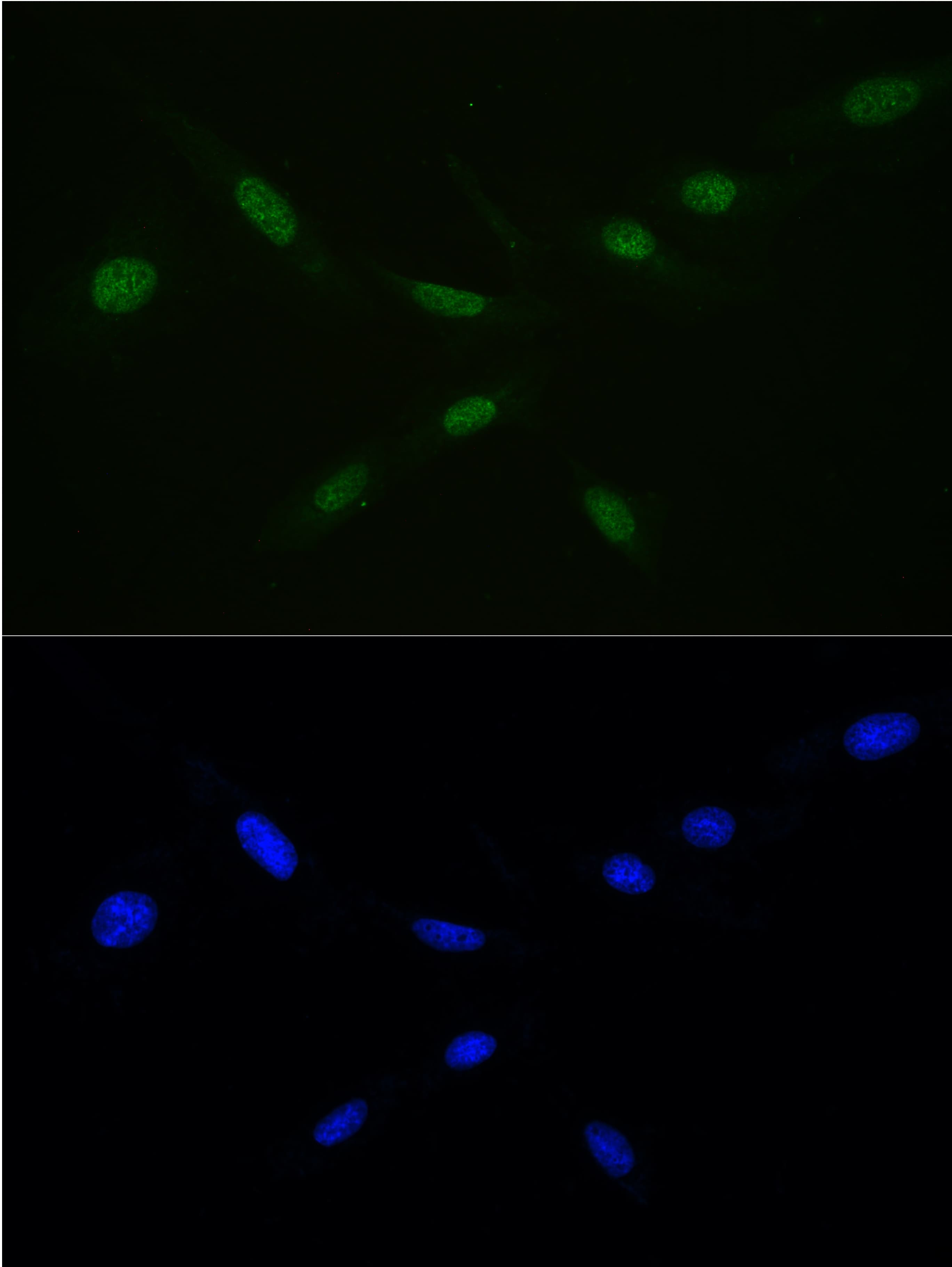 RAN Antibody