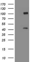 Monoclonal Mouse anti-Human MAGEA9 Antibody (clone OTI1C6, WB)