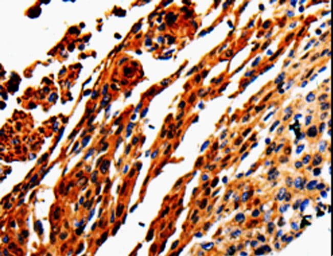 ADD1 / Adducin Alpha Antibody