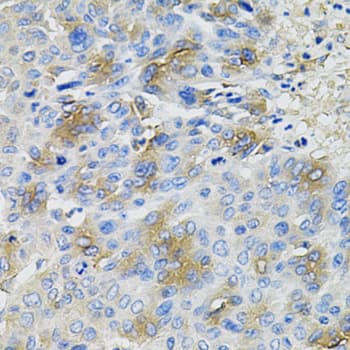 Polyclonal Rabbit anti-Human SERPINA1 / Alpha 1 Antitrypsin Antibody (IHC, IF, WB)