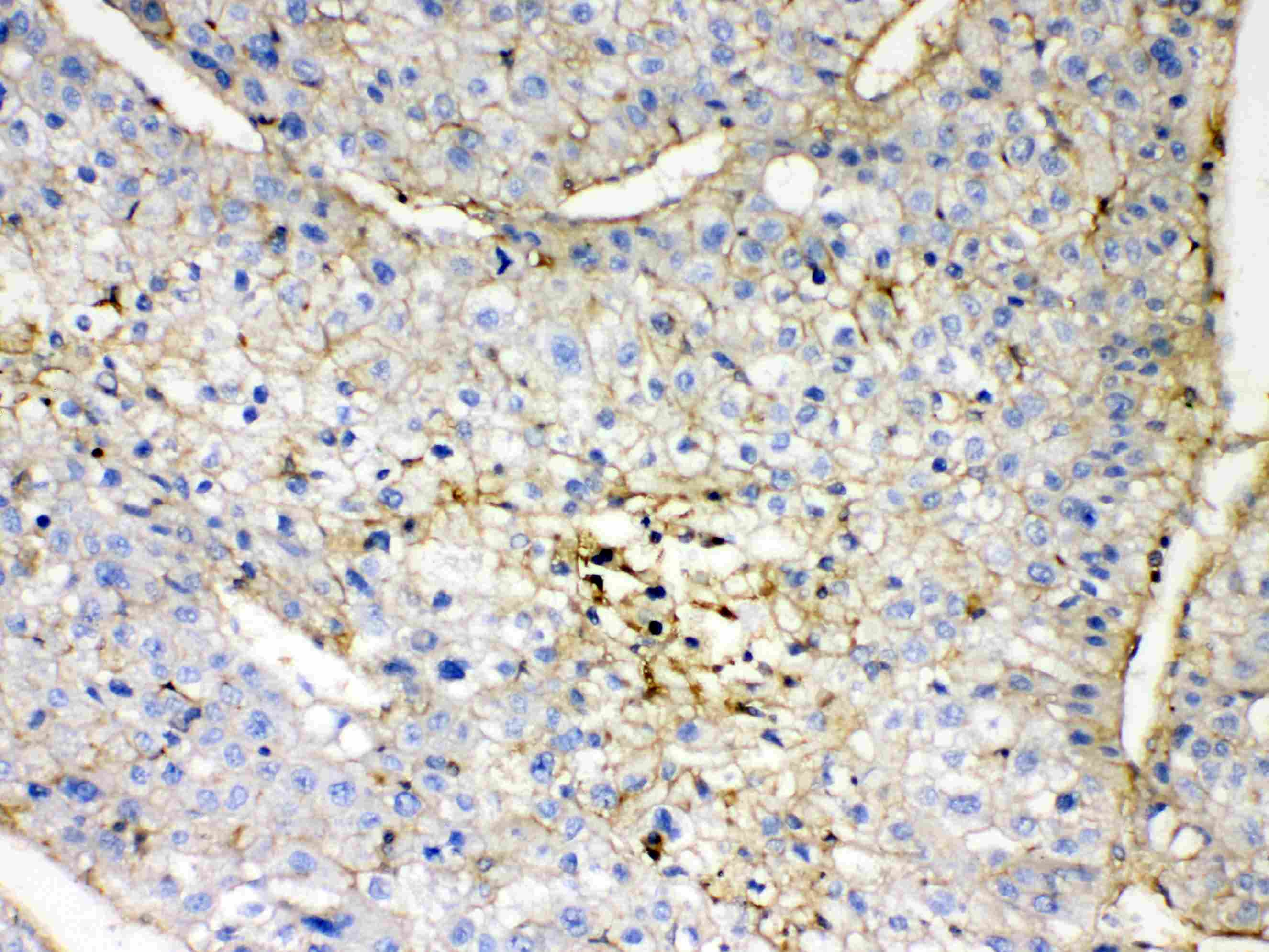 Polyclonal Rabbit anti-Human GNB1 Antibody (IHC, WB)