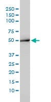 IHC-plus™ ACY1 / Aminoacylase 1 Antibody (clone 4F1-B7)