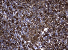 NME1 / NM23 Antibody (clone OTI2A5)