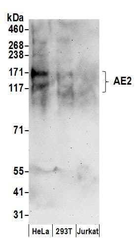 SLC4A2 / AE2 Antibody (aa275-325)