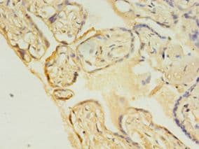 UBCH10 / UBE2C Antibody (aa2-179, HRP)