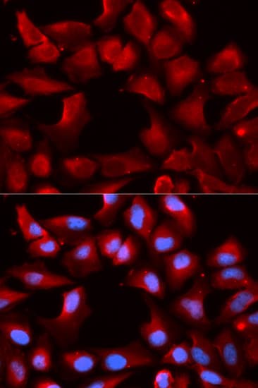 Polyclonal Rabbit anti-Human DNAJB1 / Hsp40 Antibody (IHC, IF, WB)