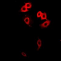 GALNT2 Antibody