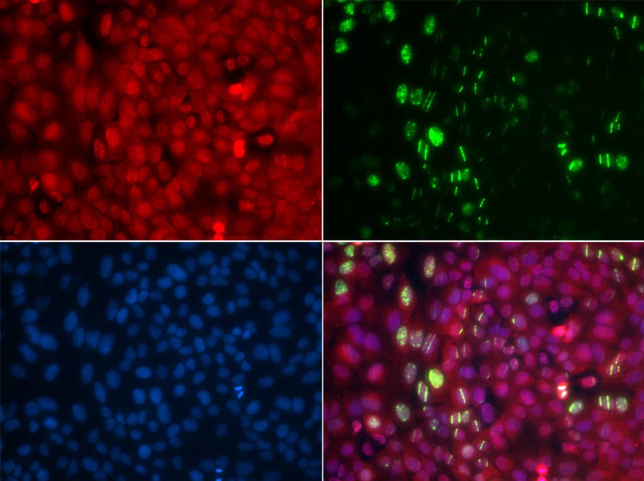 Polyclonal Rabbit anti-Human ABL1 / c-ABL Antibody (phospho-Tyr204, IF, WB)