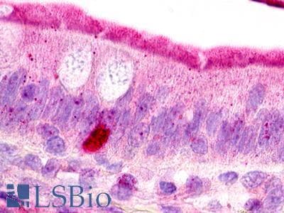 PathPlus™ C3AR / C3a Receptor Antibody (Extracellular Domain)