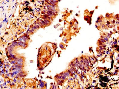 Polyclonal Rabbit anti-Human CSTA / Cystatin A Antibody