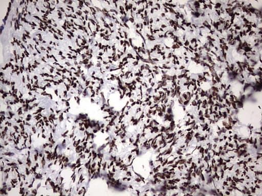 HNRPM / HNRNPM Antibody (aa1-261, clone OTI4C9)