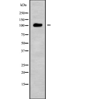Polyclonal Rabbit anti-Human USP26 Antibody (WB)