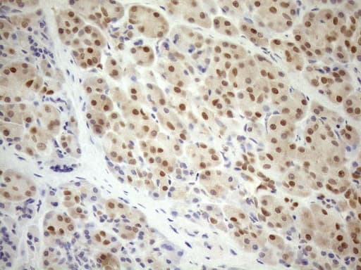MGMT Antibody (clone OTI6C4)