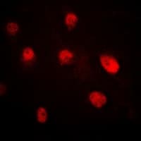 Polyclonal Rabbit anti-Human SETD8 / SET8 Antibody (IF, WB)