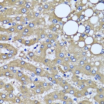 HYAL1 Antibody