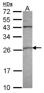 GSTA4 Antibody (aa1-222)