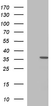 HORMAD2 Antibody (clone OTI3E4)