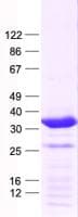 Human HMX2 Protein (Recombinant His, N-Terminal)