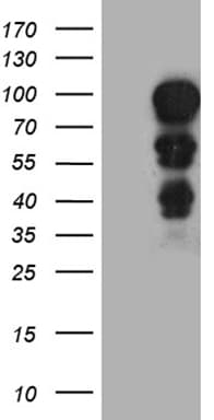 Monoclonal Mouse anti-Human MECP2 Antibody (clone OTI2F1, aa224-486, IHC, WB)