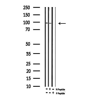 TP73 / p73 Antibody (phospho-Tyr99)