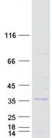 Human SSX5 Protein (Recombinant Myc-DDK (Flag))