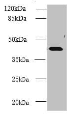 Polyclonal Rabbit anti-Human NME7 Antibody (aa1-150, IHC, WB)