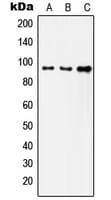 INSR / Insulin Receptor Antibody (C-Terminus)
