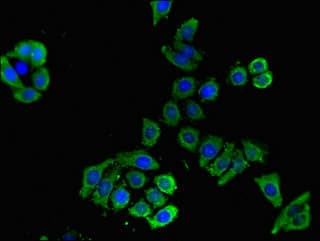 SLC16A9 Antibody