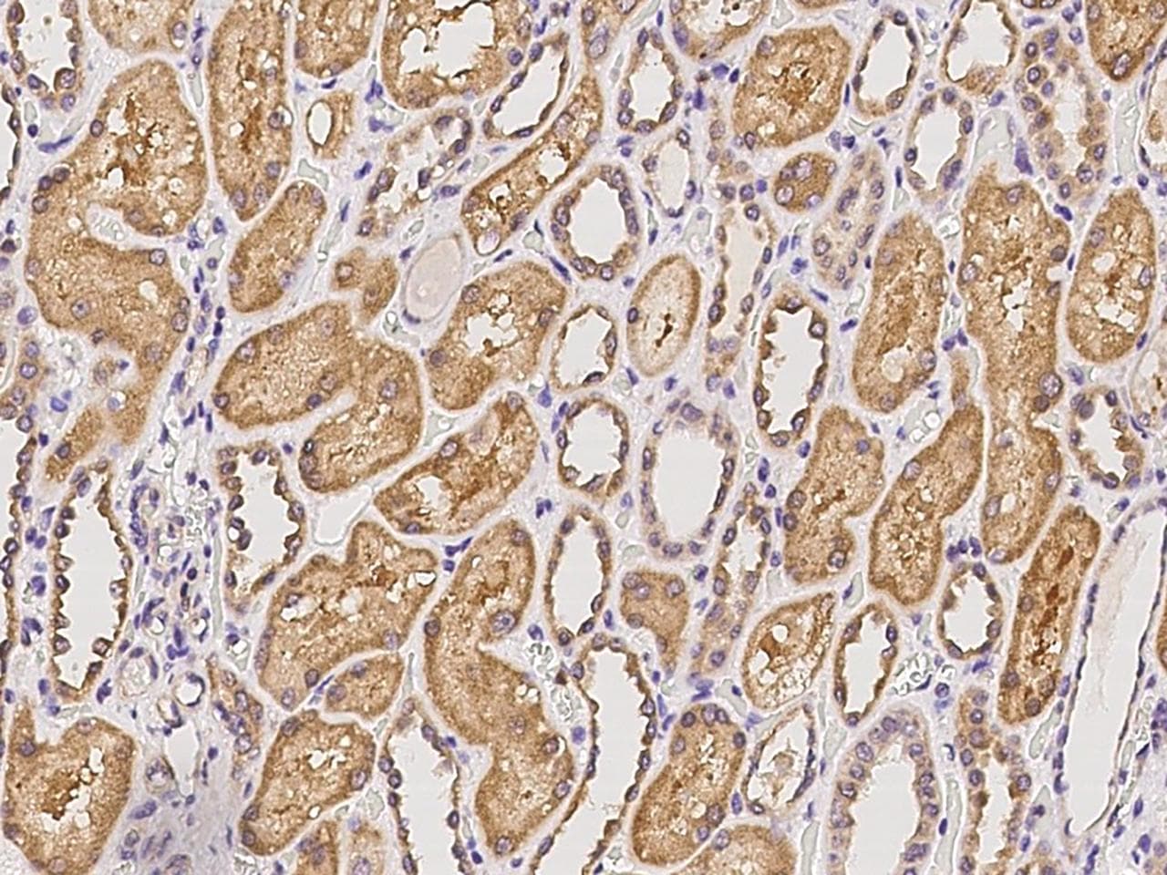 Polyclonal Rabbit anti-Human FRMPD2 Antibody (IHC)