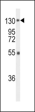 FGFR1 / FGF Receptor 1 Antibody
