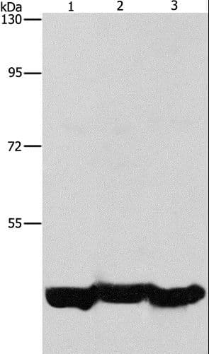 PGK1 / Phosphoglycerate Kinase Antibody