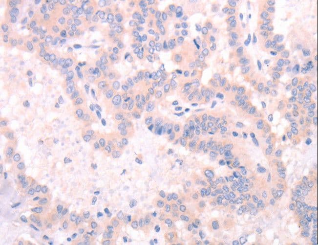 Polyclonal Rabbit anti-Human INA / Alpha Internexin Antibody (IHC, WB)