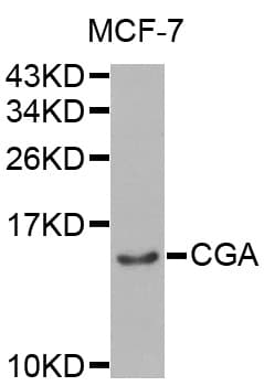 Polyclonal Rabbit anti-Human CGA / hCG Alpha Antibody (WB)