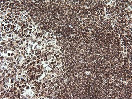 RTKN / Rhotekin Antibody (clone OTI2E9)