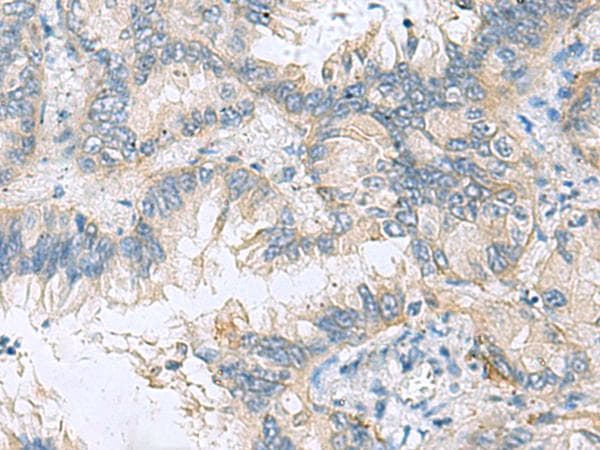 Polyclonal Rabbit anti-Human TAGLN3 / Neuronal Protein 22 Antibody (IHC)