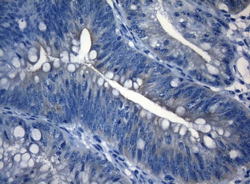 RAB3IP / RABIN3 Antibody (clone OTI5F2)